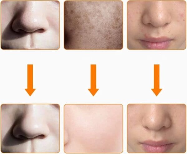 Led licht gezichtsmasker met hals gedeelte - 7 kleuren voor 7 behandelingen -Licht therapie - Gezichtstherapie - Led mask - Afbeelding 8